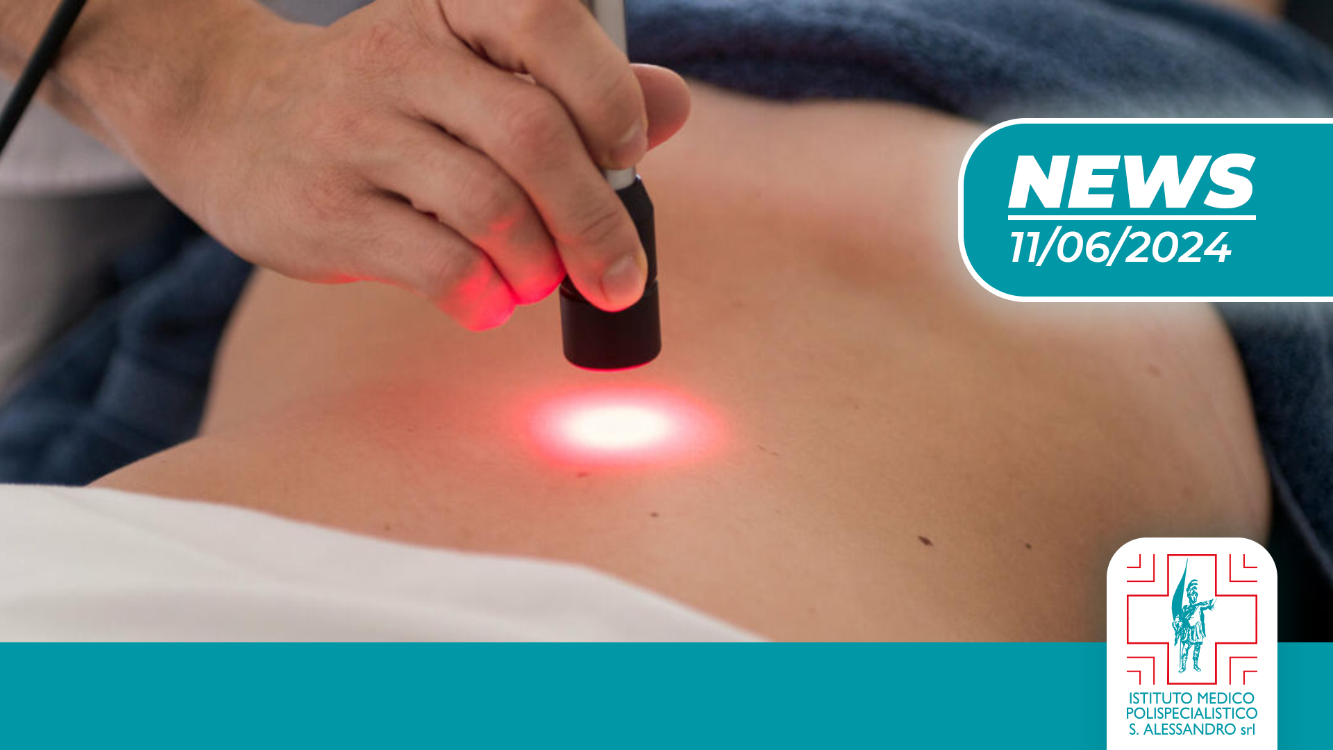 Laser terapia